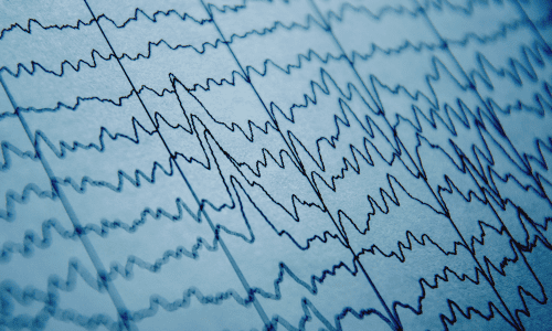 EEG & EMG Testing in Jackson, MS EEG & EMG Testing in Jackson, MS